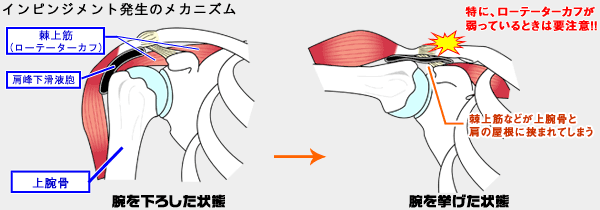 メカニズム