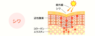 UV-A