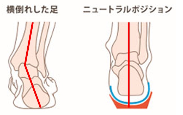 回内足